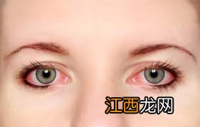 ?夏季如何预防红眼病