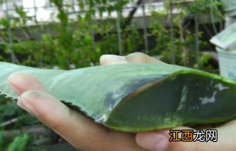 库拉索芦荟可以祛痘吗 库拉索芦荟可以祛痘吗新闻报道