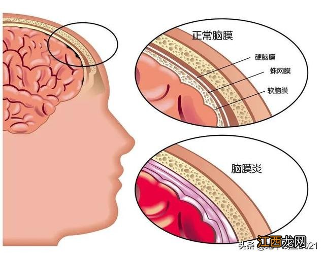 ac结合和a群有什么区别 ac结合