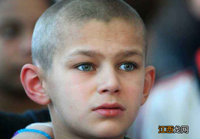 宝宝白眼珠发蓝图片 宝宝眼白发蓝图片