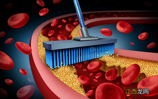 血栓是怎么回事血栓是怎么形成的 血栓吃什么药可以疏通血管