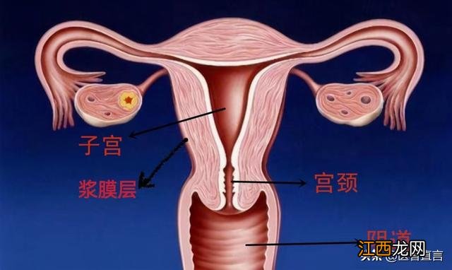 爱母环多少钱一个月 爱母环多少钱一个