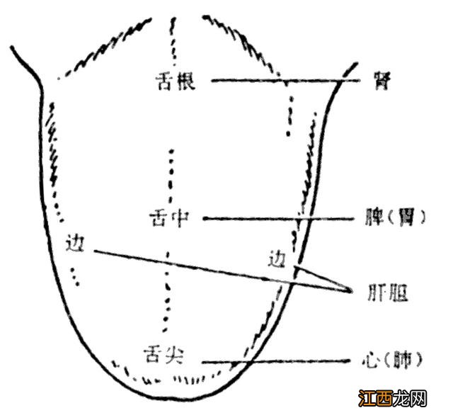 舌裂纹吃什么可以恢复 舌面上有裂纹是什么病