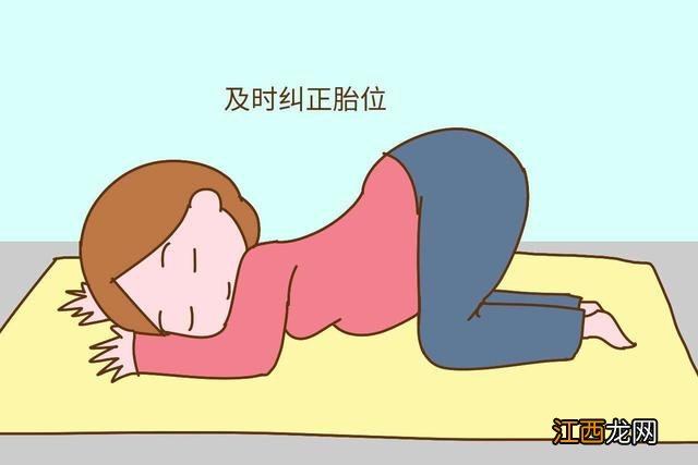 rot胎位是什么意思