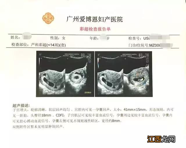 验孕棒双杠一定怀孕吗 验孕棒双杠一定怀孕吗