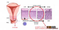 四价二价和九价的区别 二价和九价的区别