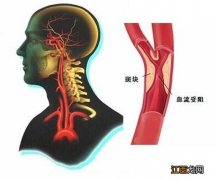 猪油的功效与作用偏方 猪油的功效