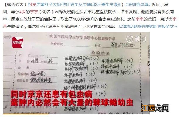 小儿蛔虫病的症状出现白斑 小儿蛔虫