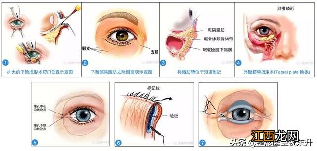 眼睑是哪里?图 眼睑是哪里图解