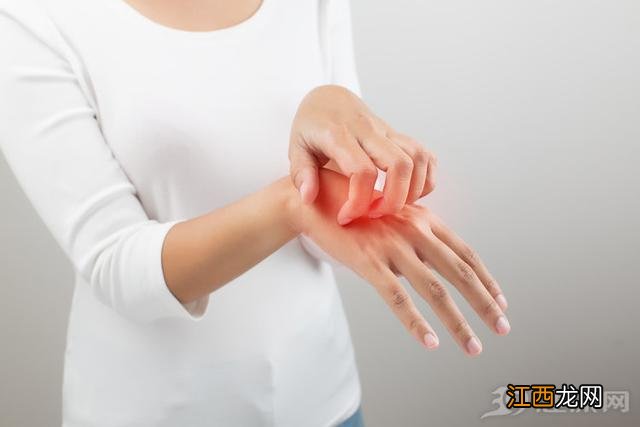 湿疹药膏排行榜宝宝 湿疹药膏排行榜