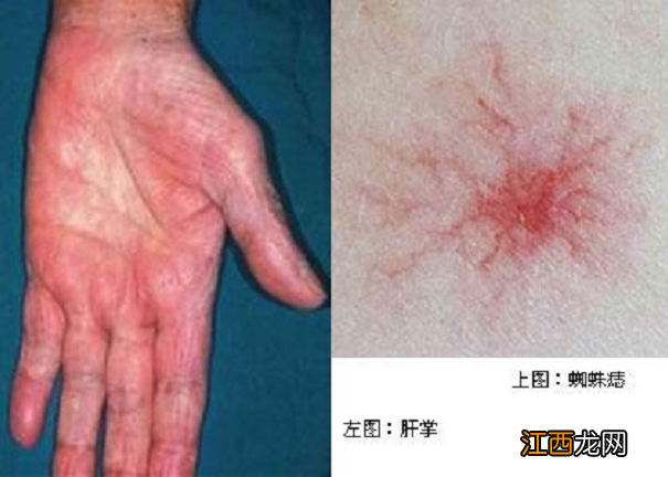 丁香红茶图片 丁香红茶