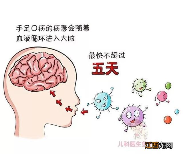 宝宝手足口病的症状图 初期 宝宝手足口病的症状图