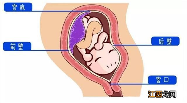 胎盘后壁和前壁有什么区别 胎盘后壁