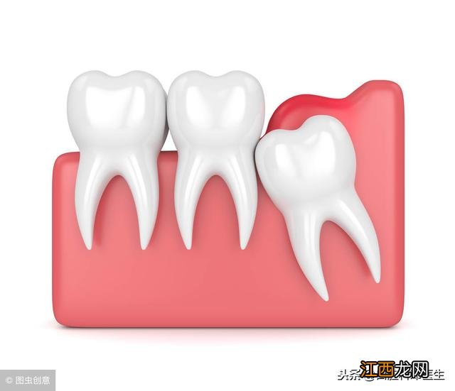 怎么确定是智齿痛