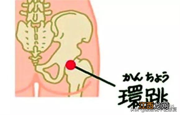 坐骨神经痛怎么治疗方法最快 臀部穴位图