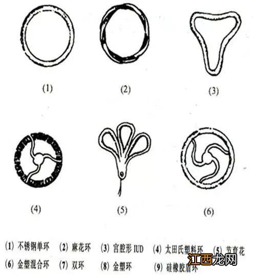 曼月乐环取环痛不痛 曼月乐取环痛不痛