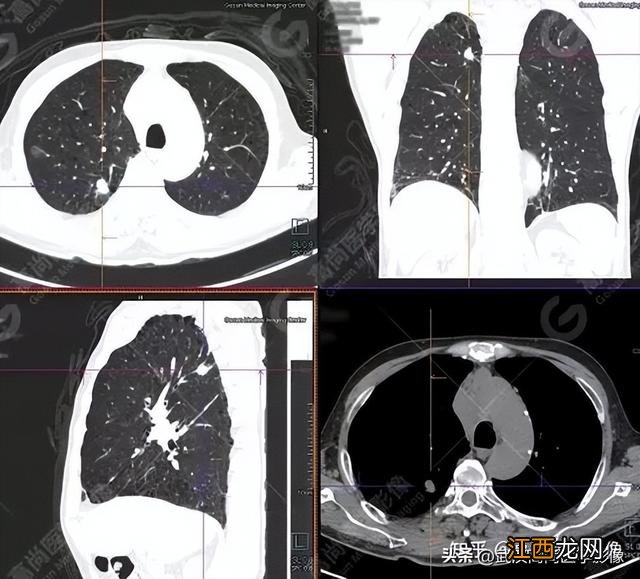 2厘米尺子真实图 2cm标准图片
