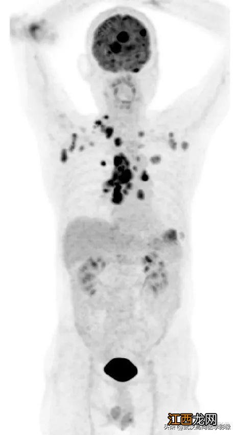 2厘米尺子真实图 2cm标准图片