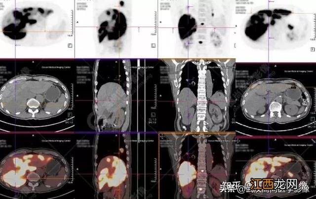 2厘米尺子真实图 2cm标准图片