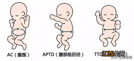 胎芽变成胎儿头臀径 胎儿头臀径