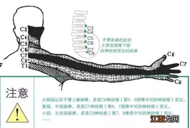 手麻最简单的土方子 手麻了如何迅速恢复