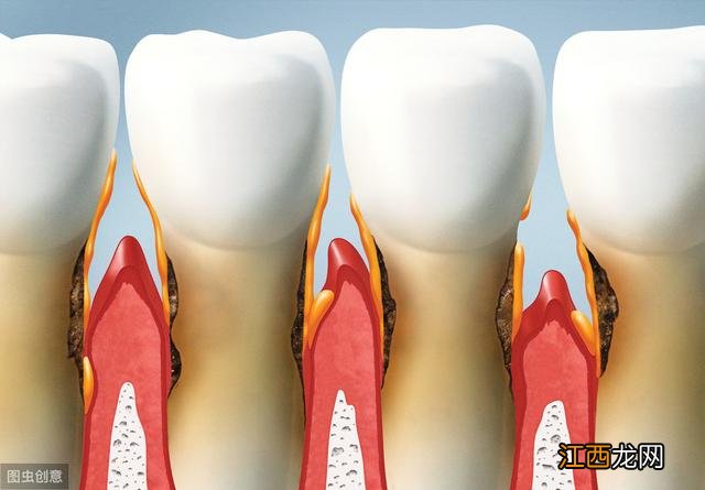 治牙疼最快的方法2秒 治牙疼最快的方法