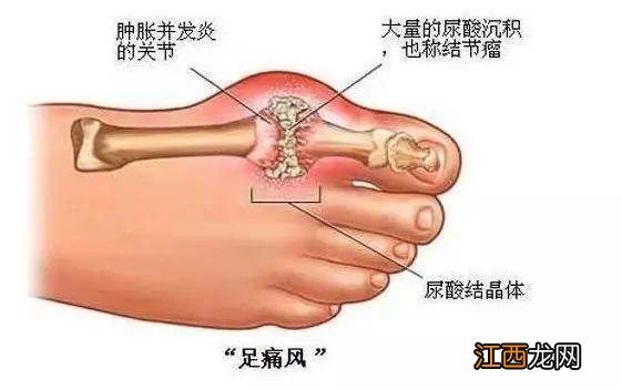 血糖参照表 血糖对照表