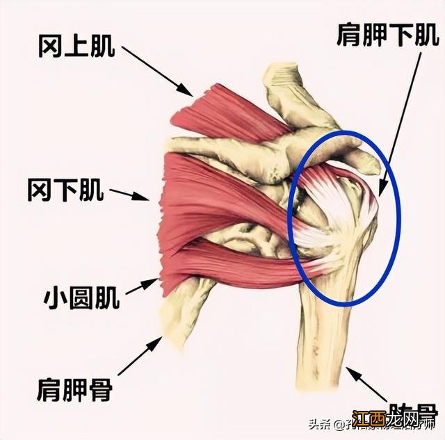 肩膀酸痛是什么原因引起的