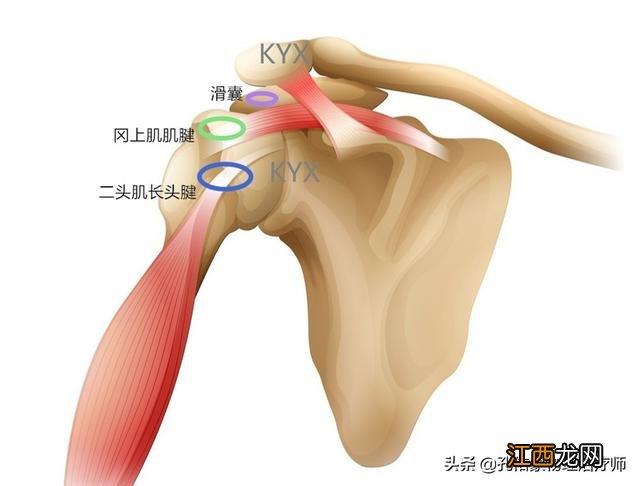 肩膀酸痛是什么原因引起的