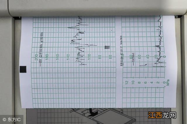 怀孕胎心多少是男孩 胎心多少是男孩