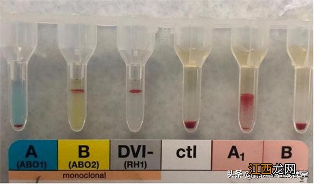 o型血和ab型血容易怀孕吗 o型血和ab型血