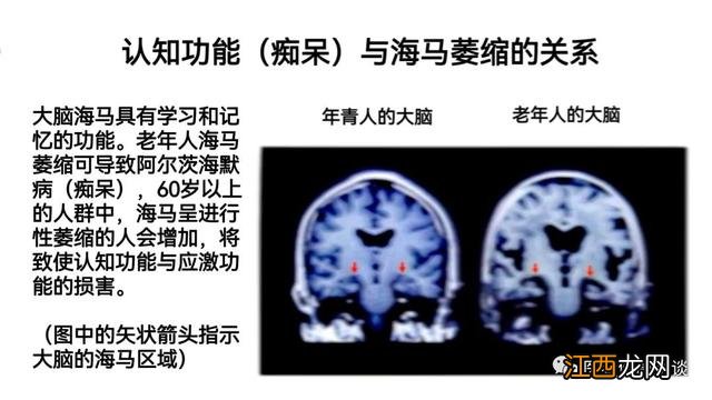 卵磷脂的功效与作用及副作用 卵磷脂副作用