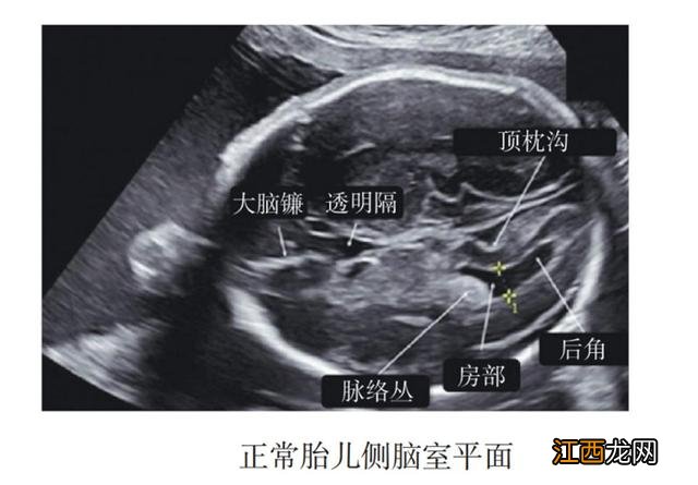 头臀径是指什么50mm 头臀径是指什么