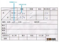 瞳距65.5正常吗 瞳距65正常吗