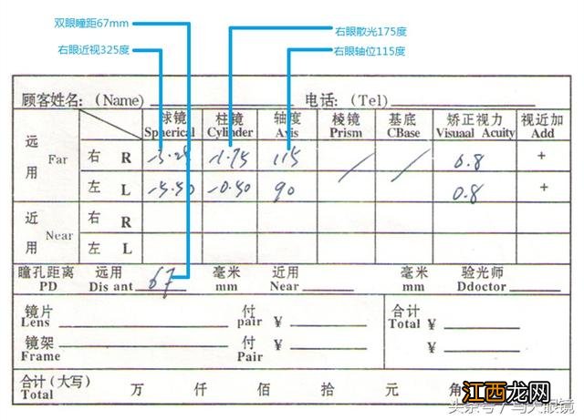 瞳距65.5正常吗 瞳距65正常吗