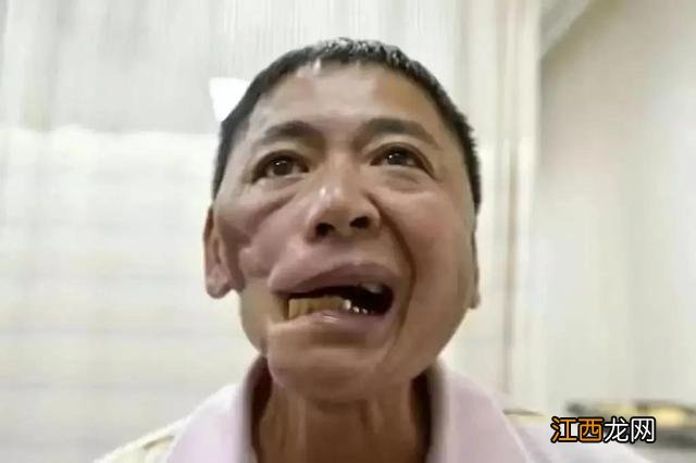 怎样戒槟榔 怎么戒槟榔