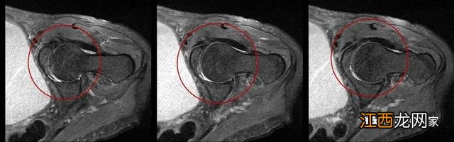 牛的髋骨图片 髋骨图片