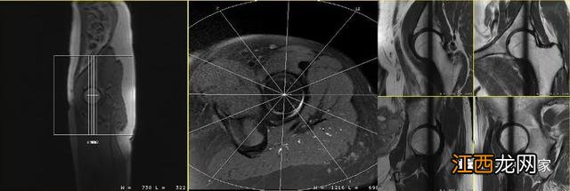 牛的髋骨图片 髋骨图片