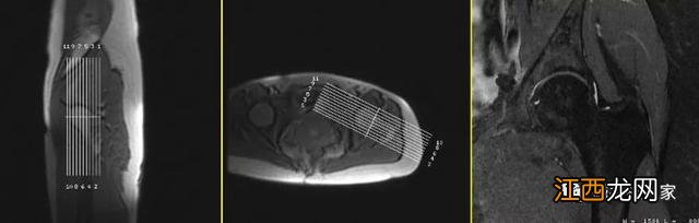 牛的髋骨图片 髋骨图片