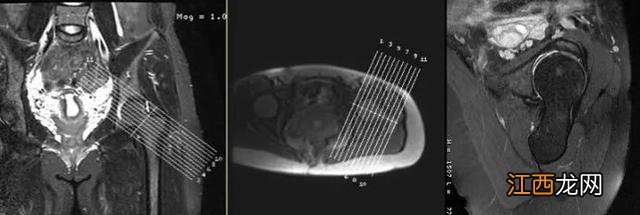 牛的髋骨图片 髋骨图片