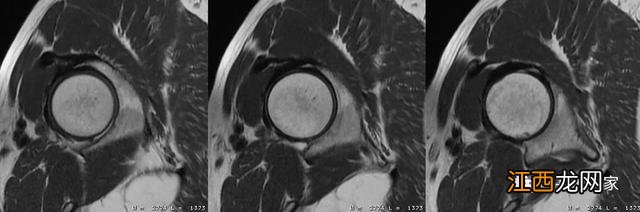 牛的髋骨图片 髋骨图片