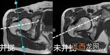 牛的髋骨图片 髋骨图片