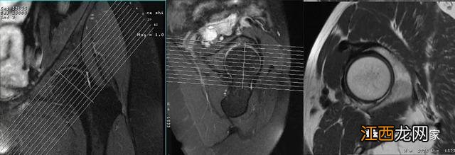 牛的髋骨图片 髋骨图片