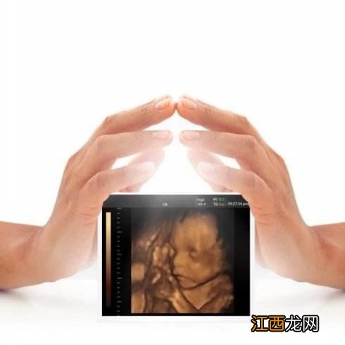 做四维最佳时间 做四维的最佳时间