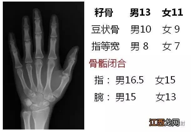 骨龄预测身高图早熟2.3岁11岁154 骨龄预测身高图