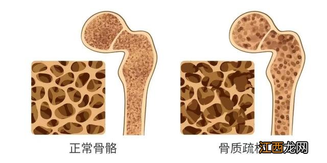 10毫克是多少克图片 10毫克是多少克