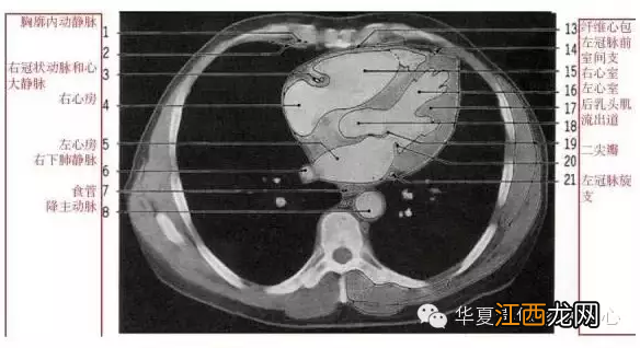 心脏在人体什么位置 心脏示意图