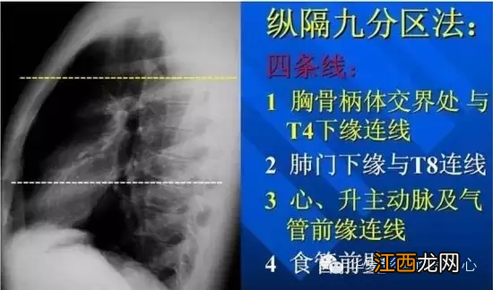 心脏在人体什么位置 心脏示意图