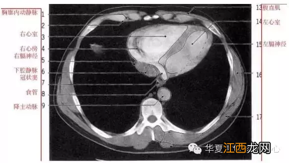 心脏在人体什么位置 心脏示意图