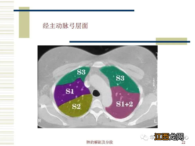 心脏在人体什么位置 心脏示意图